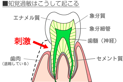 sec1_image